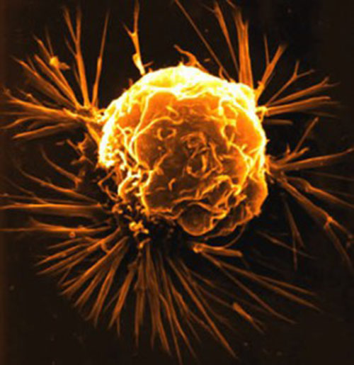 Carcinosinum (A nosode from Carcinoma (CARCINOSIN))
