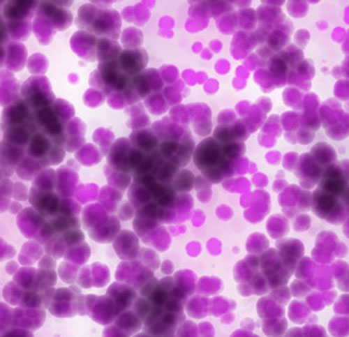 Medorrhinum (The Gonorrhoeal Virus)