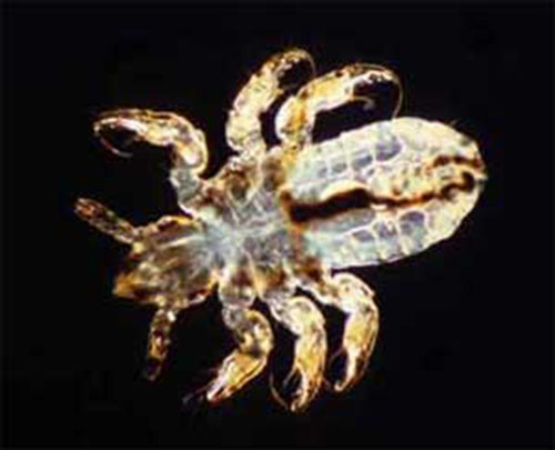 Psorinum (Scabies Vesicle)